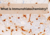What is Immunohistochemistry