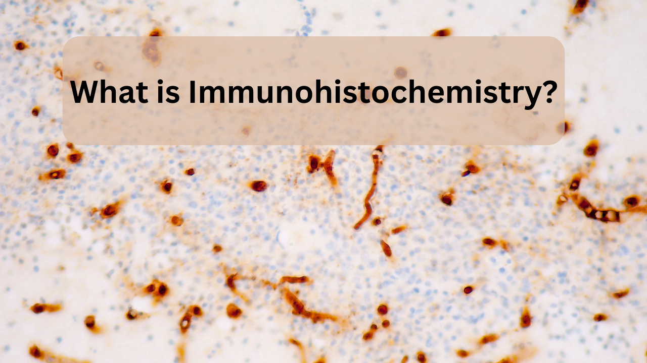 what is immunohistochemistry